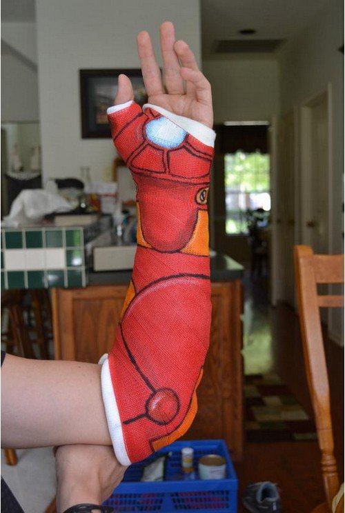 16 People Making The Best Out Of A Bad Situation With Their Casts