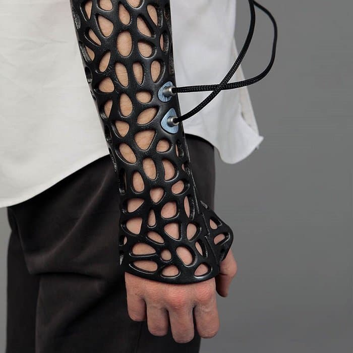 3d-printed-cast-deniz-karasahian arm