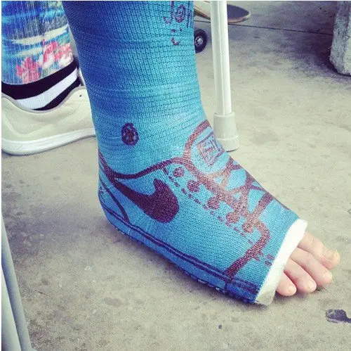 blue sneaker cast