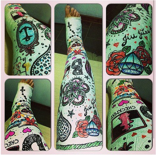 leg cast tattoos