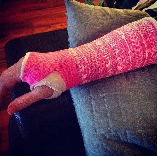 pink patterned cast