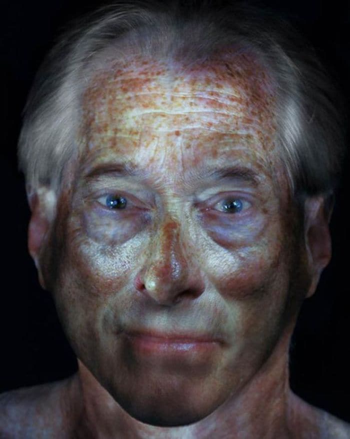 freckled man illuminated