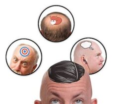 Bald Head Temporary Tattoos