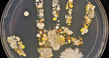 Microbes On Boys Hand After Playing Outside