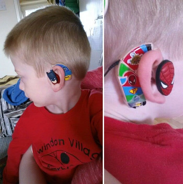 boy hearing aids