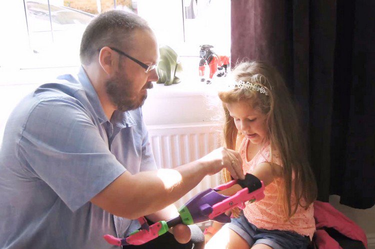 man fitting prosthetic arm