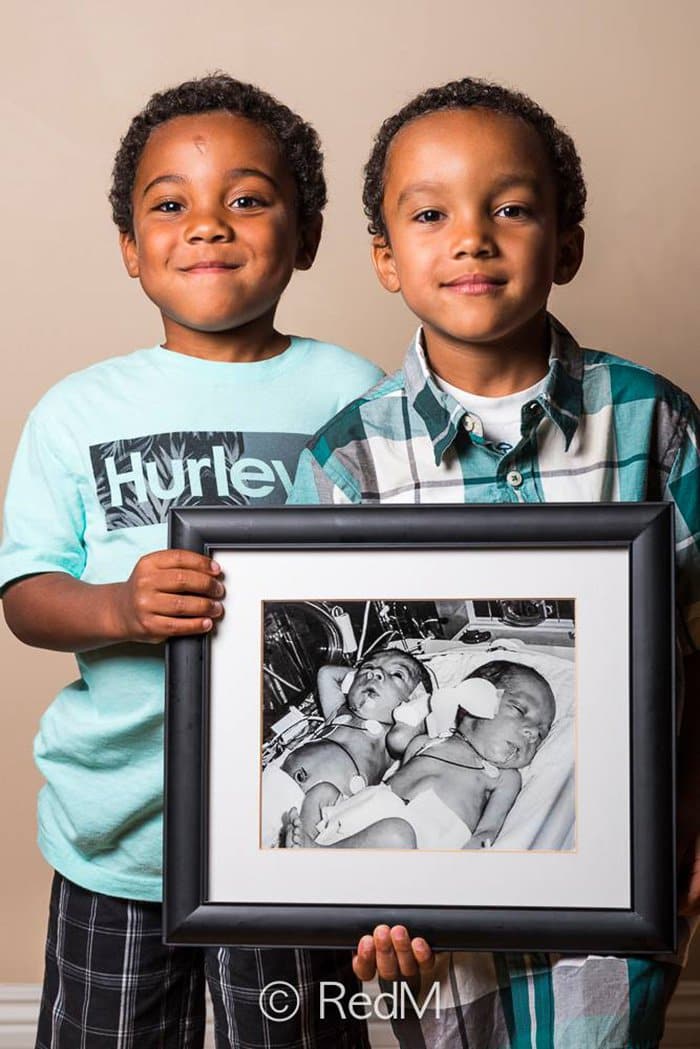 premature-baby-portraits-noah-nathan