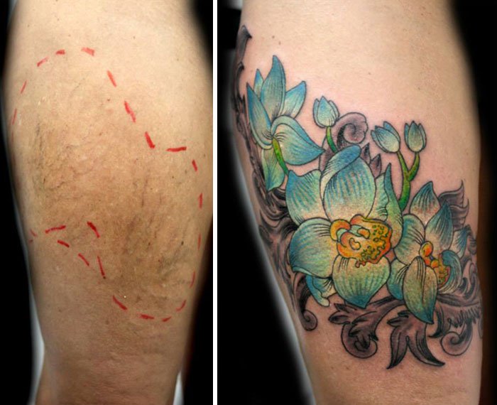 scars-tattoo