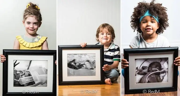 Before-And-After Photos Premature Babies