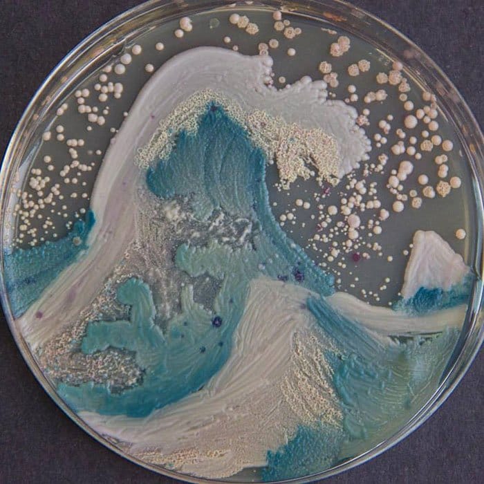 microbe-art-contest-candida-wave