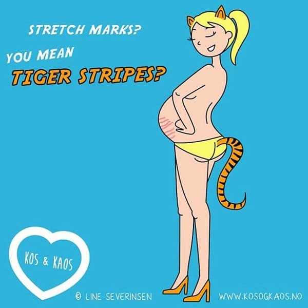 pregnant-mother-problems-stretch-marks
