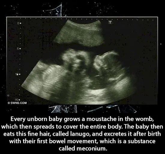 ultrasound of a baby 