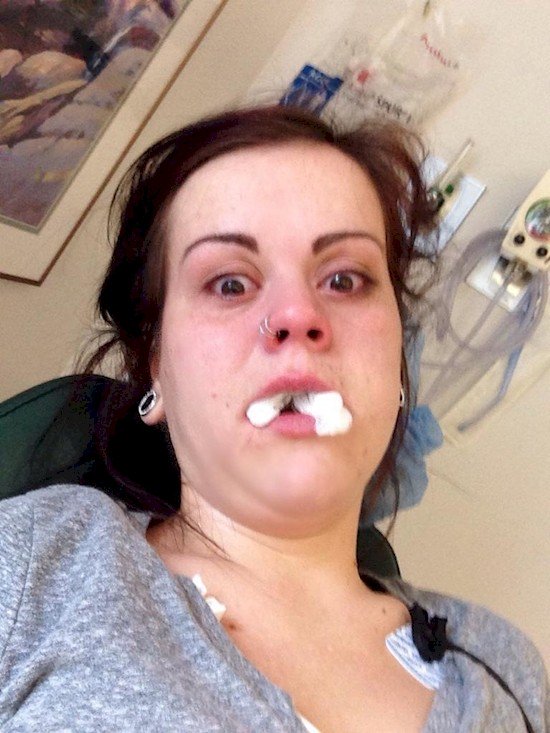 oral surgery selfie