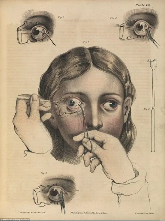 medical-eyes