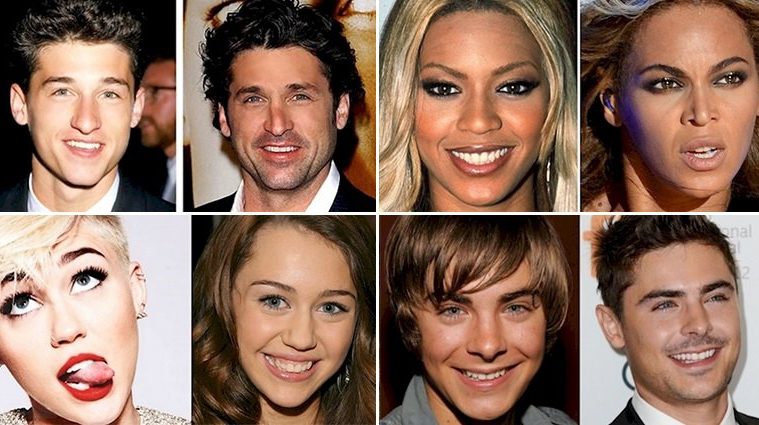 9 Before And After Comparison Photos Of Celebrity Nose Jobs