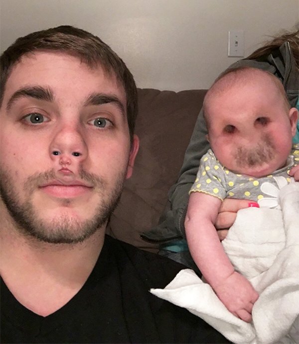face-swaps-nose