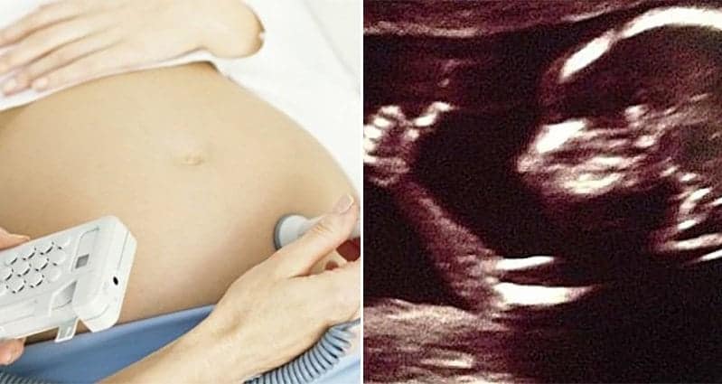 Womb Transplants Approved United Kingdom