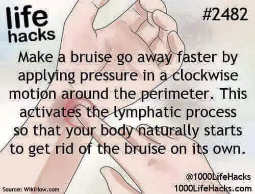 life-hacks-bruise