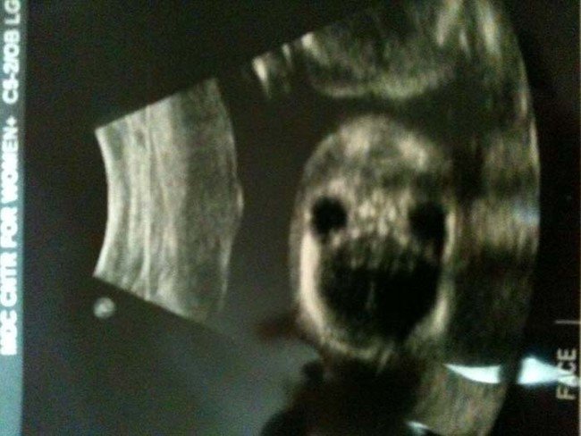 scary-ultrasound