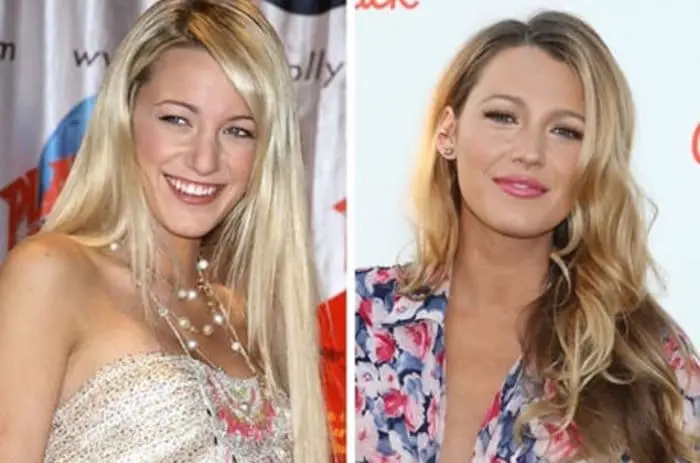 celebs-before-after-stylists-blake-lively