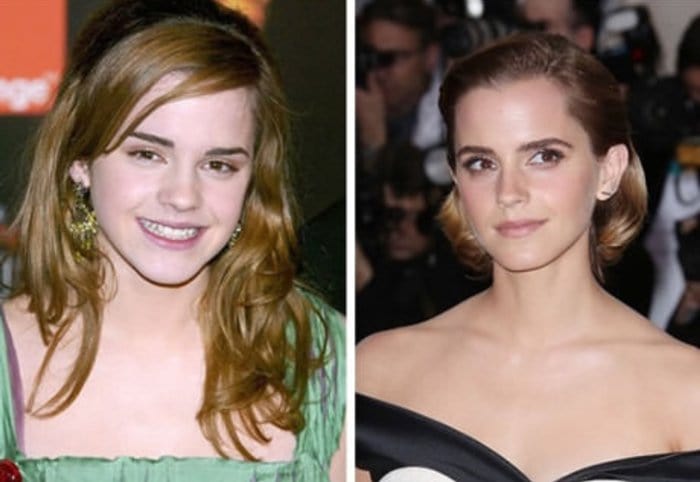 celebs-before-after-stylists-emma-watson