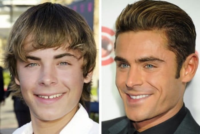 celebs-before-after-stylists-zac-efron