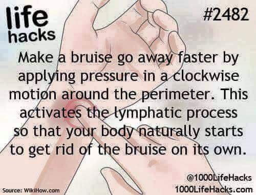 life-hacks-bruise-go-away-faster