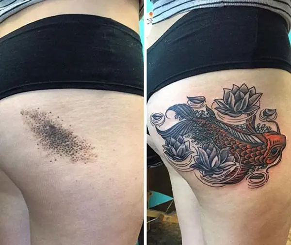 birthmark-tattoo-cover-ups-camoflage