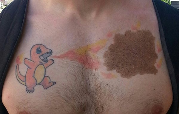 birthmark-tattoo-cover-ups-charmander