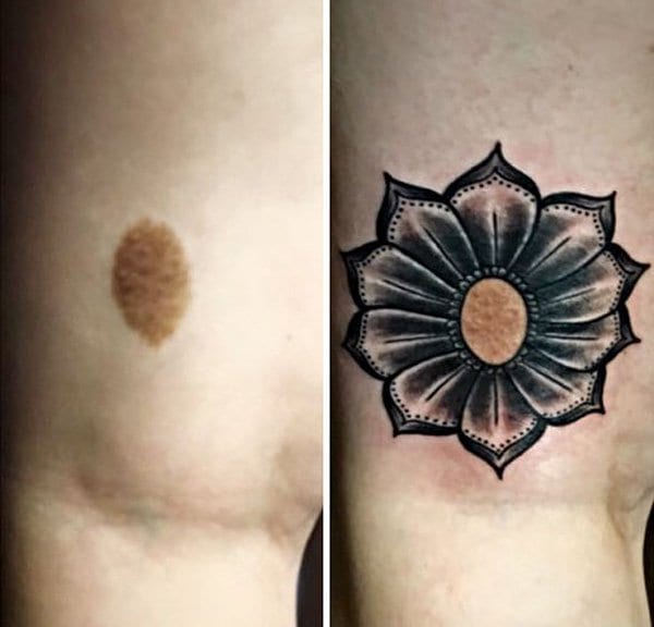 birthmark-tattoo-cover-ups-flower