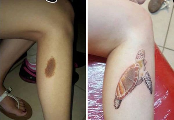 birthmark-tattoo-cover-ups-turtle