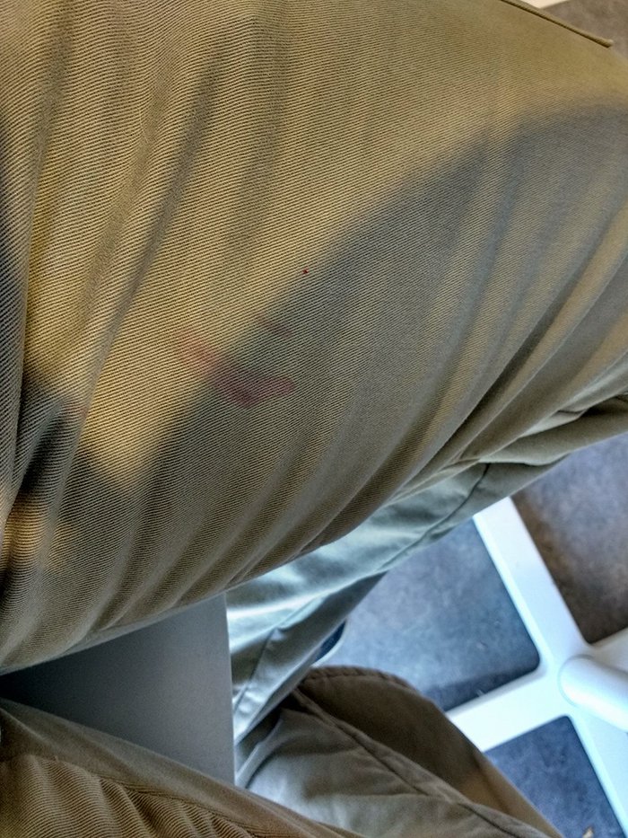 guy documents trip to ikea trouser stain
