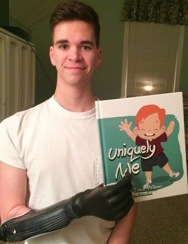 prosthetic hand guy book