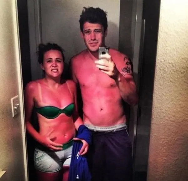 bad-sun-burn couple
