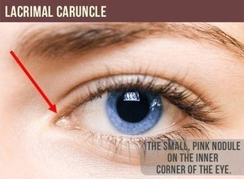 lacrimal caruncle small pink nodule eye