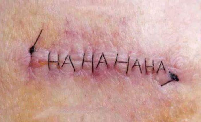 hahahaha stitches