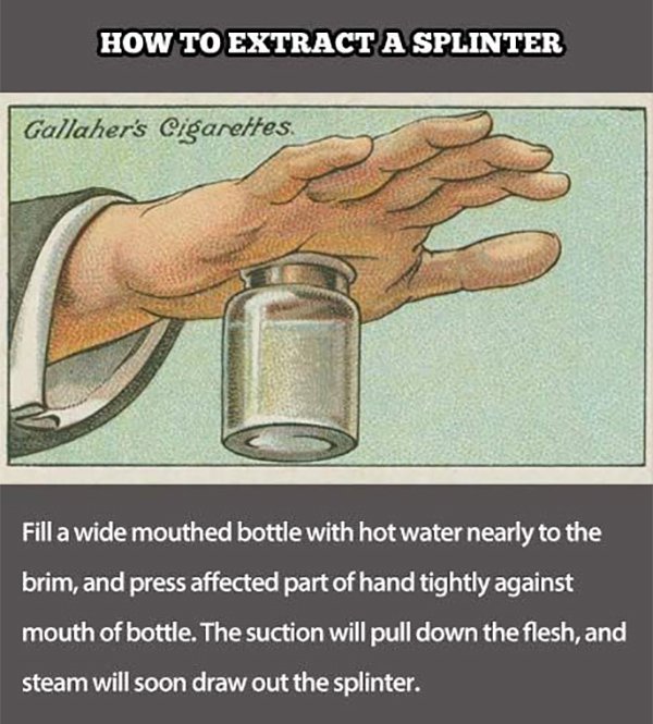 how to extract a splinter