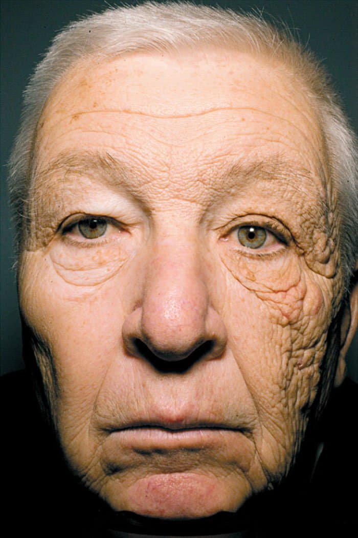 Pictures That Prove Time Changes Everything sun damage after 25 years