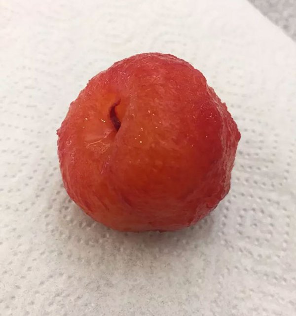Pictures Of Peeled Fruit plum