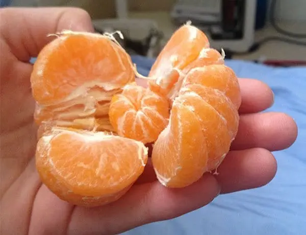 Times People Won The Food Lottery orange inside orange