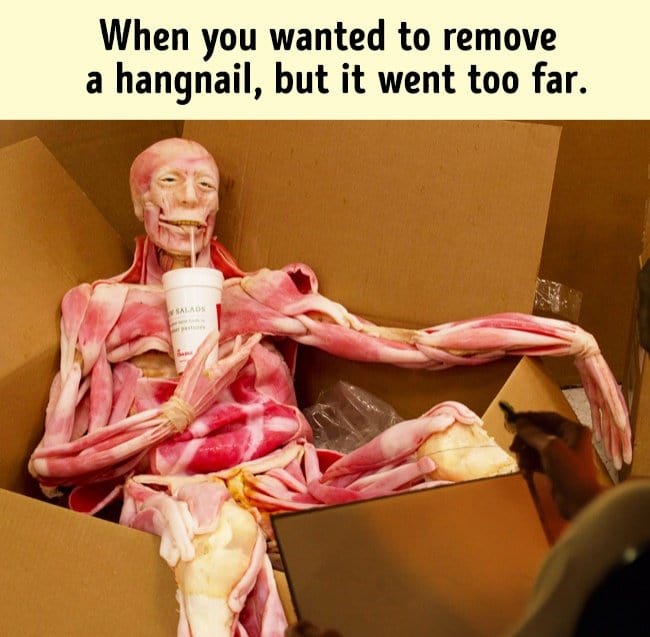 Amusing Jokes hangnail went to far