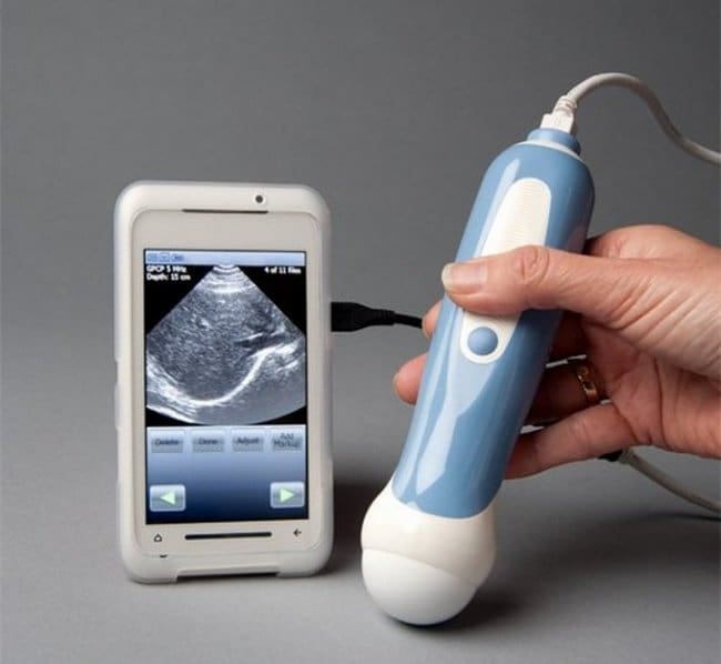 Inventions For Parents smartphone ultrasound scanner
