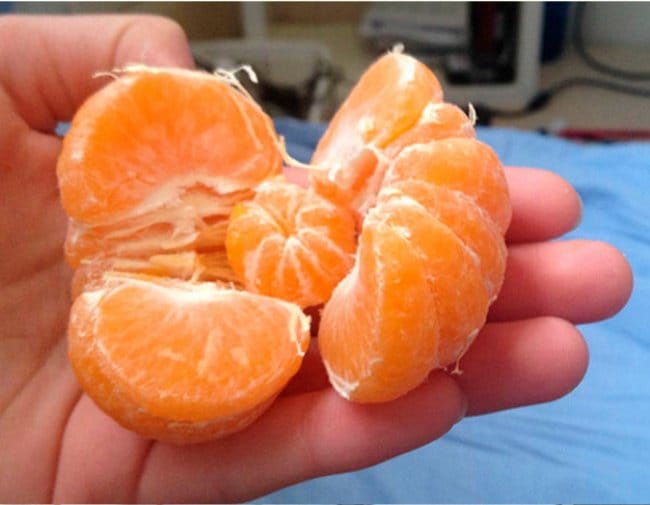Times Lucky People Hit The Food Jackpot pregnant tangerine