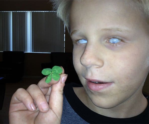 Rare Coincidences blind son finds four leaf clover