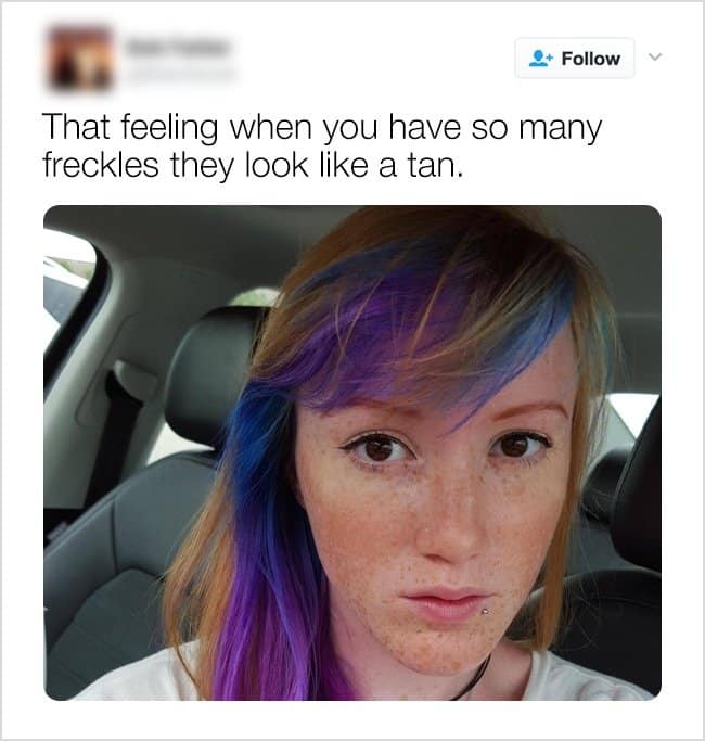 The Struggles Of Being A Redhead so many freckles
