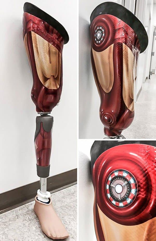 Hilarious Uncles iron man prosthetic