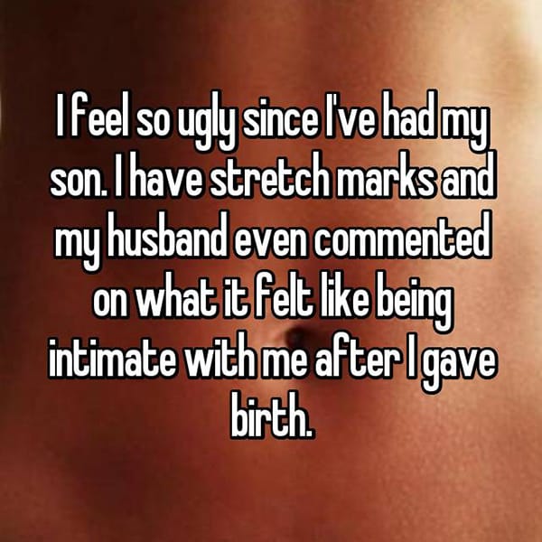 Realities Of Life After Giving Birth stretch marks