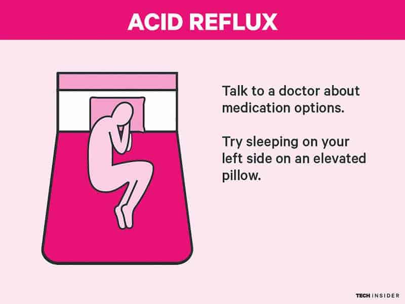 acid-reflux