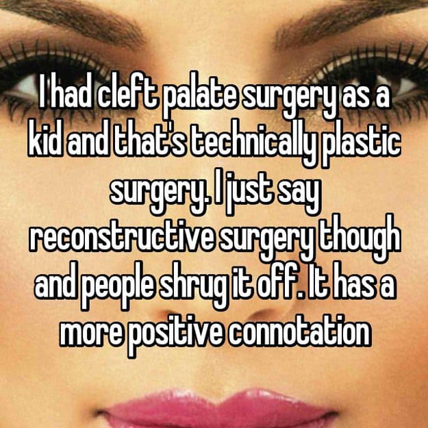 cleft-palate-as-a-kid-reconstructive-surgery-stories