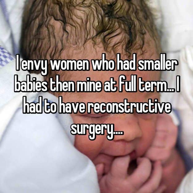 envy-women-who-have-smaller-babies-reconstructive-surgery-stories